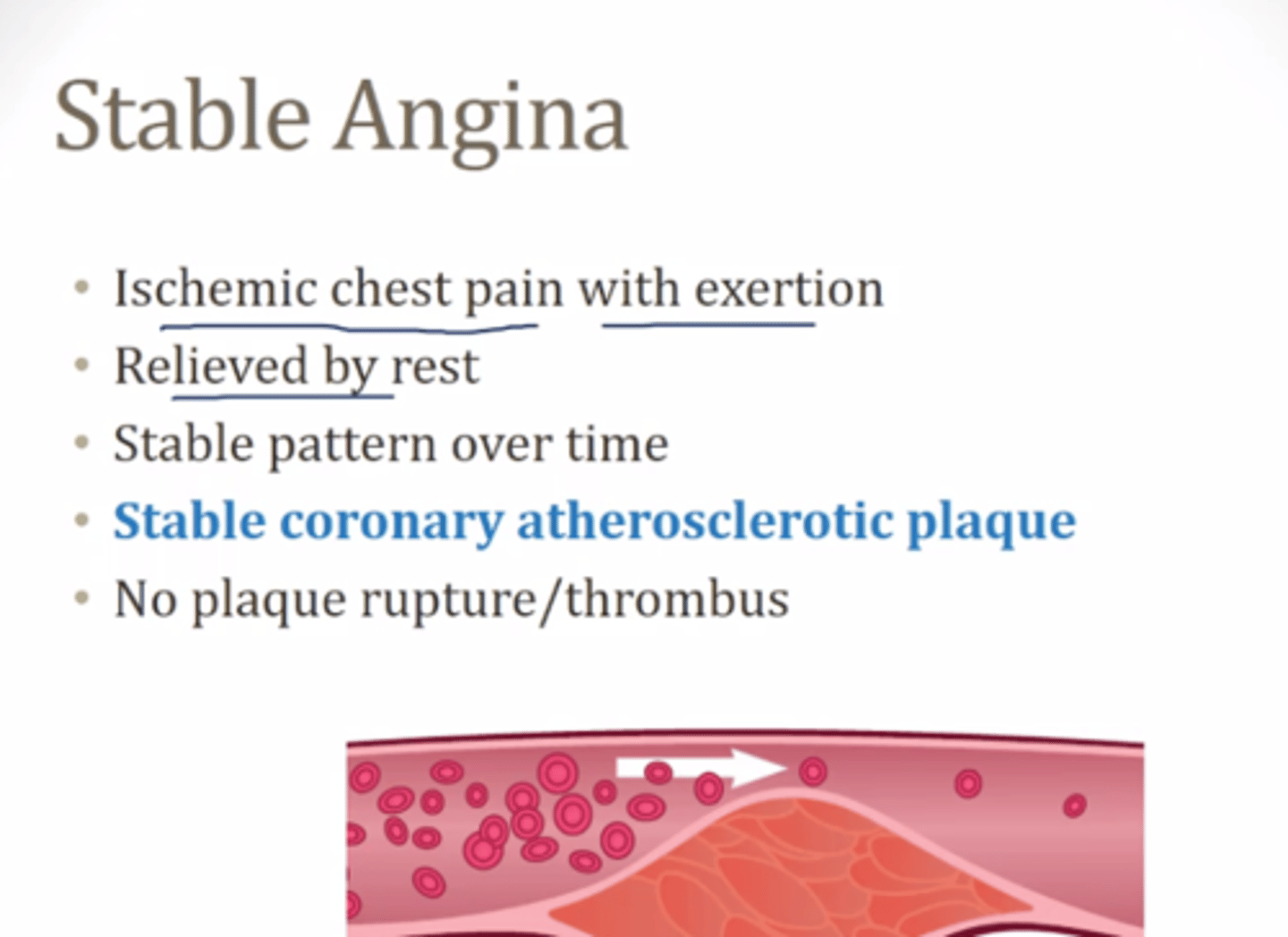 <p>chronic angina pectoris</p><p>- similar characteristics and occurs each time under same circumstances</p>