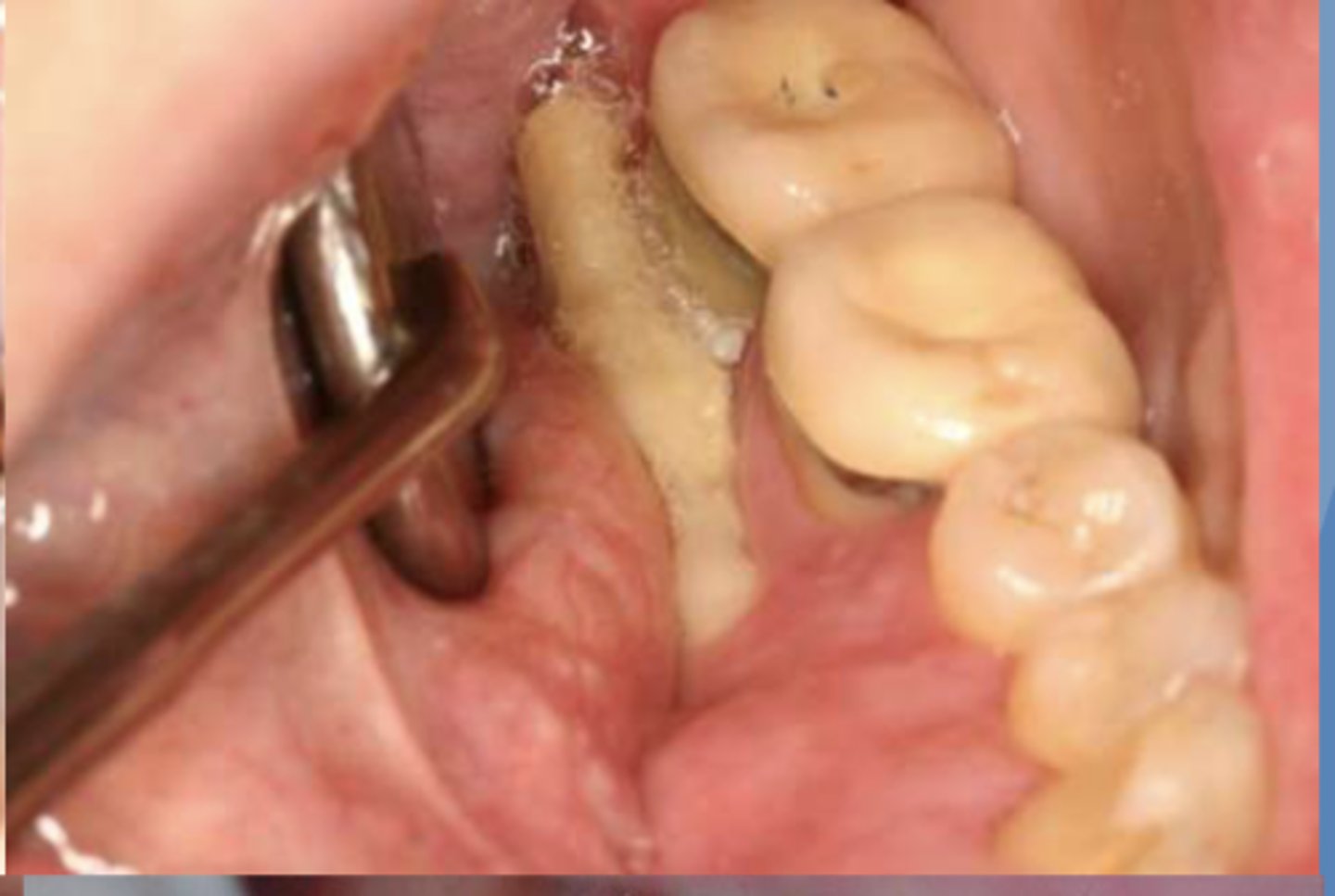 <p>what do you suspect?</p>