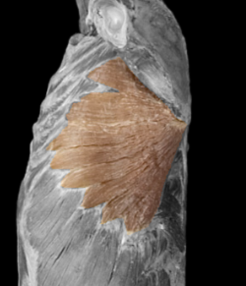 <p>What muscle is this? </p>