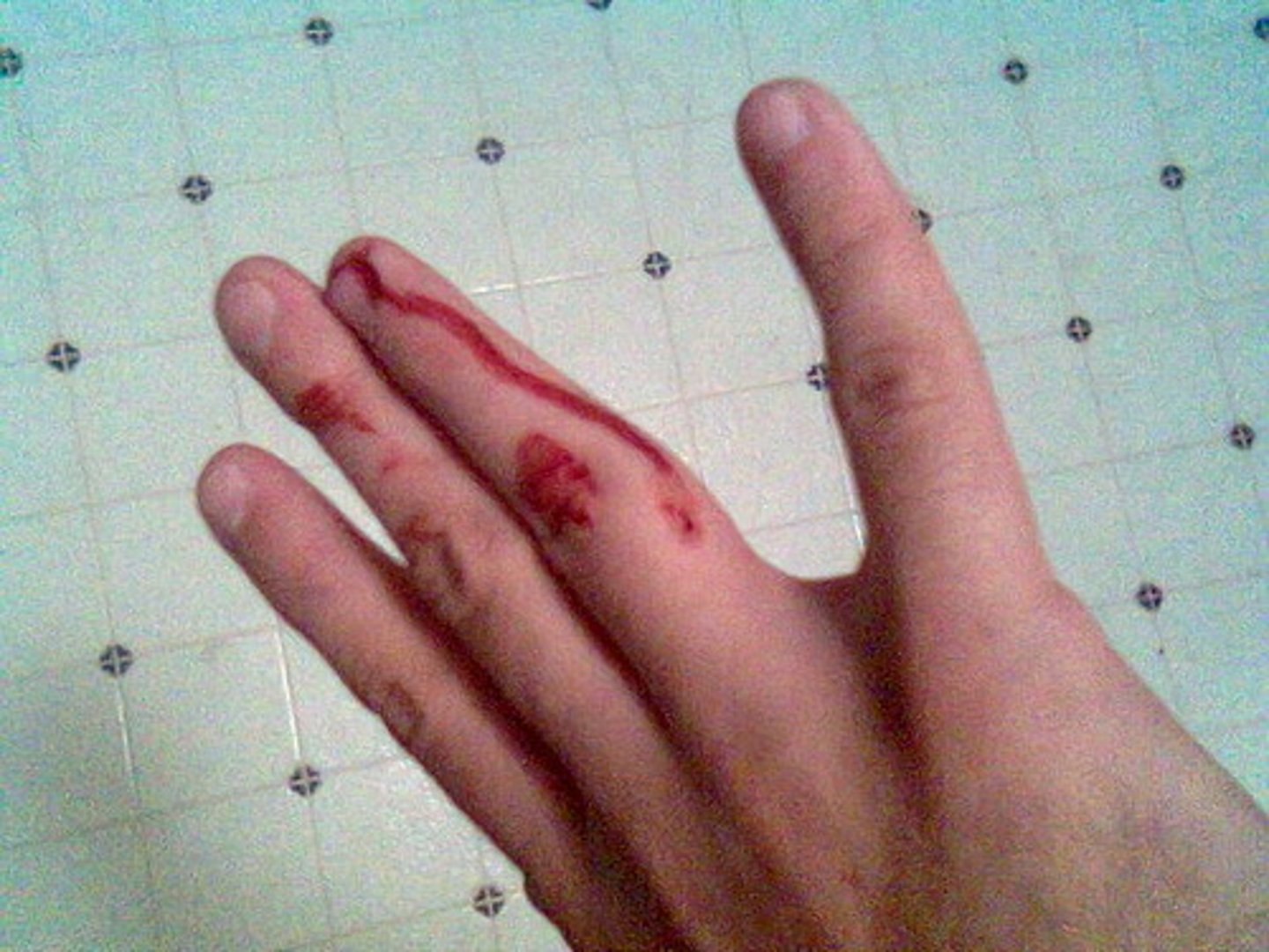 <p>A disorder in which blood does not clot normally</p>