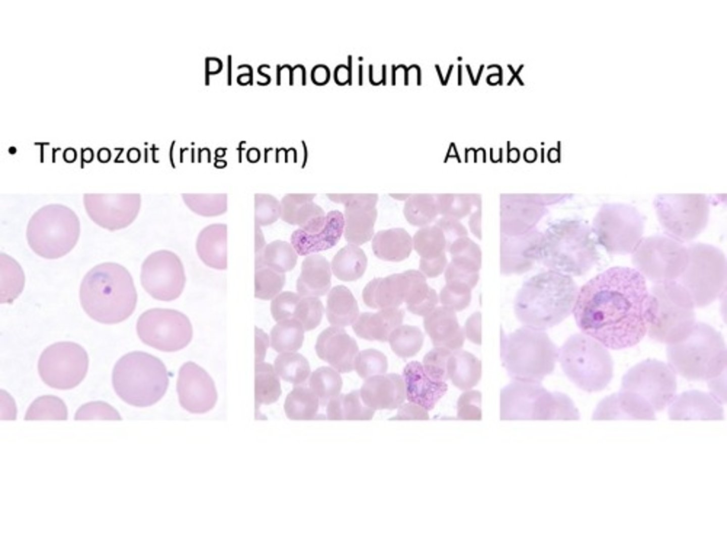 <p>The presence of ring form trophozoites and Schuffner's dots may indicate:</p>