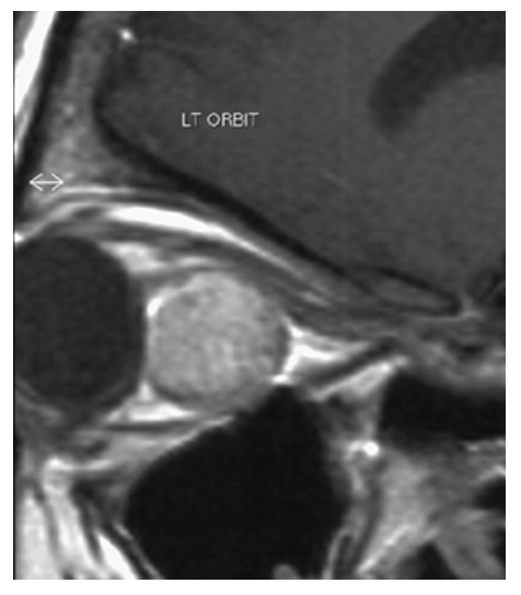 <p>What does the figure show?</p>