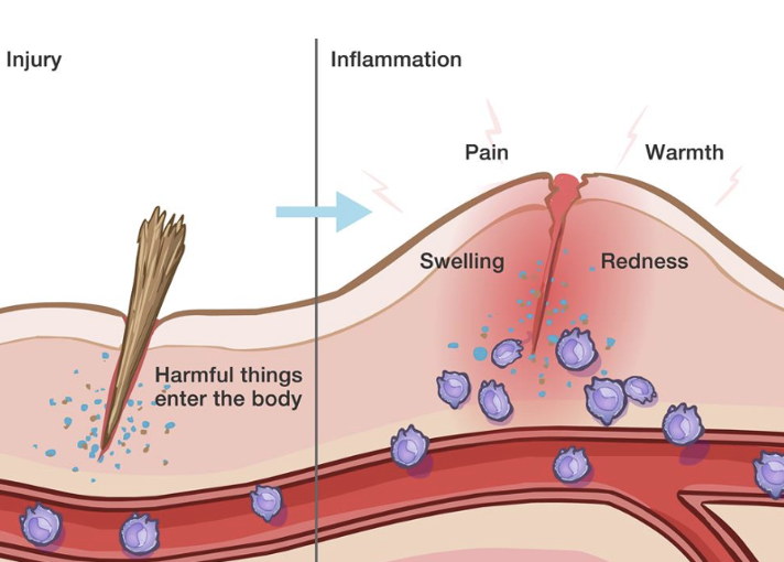 <ul><li><p>when physical barriers are breached, innate immunity triggers an inflammatory response </p></li><li><p>releases signalling molecules such as cytokines and chemokines </p></li><li><p>they recruited immune cells to the site of infection  </p></li></ul><p></p>