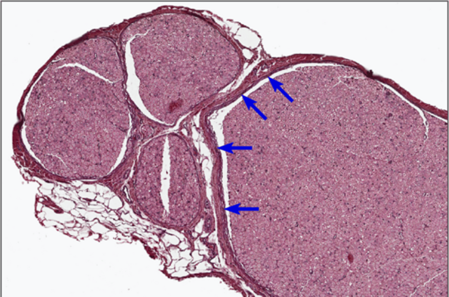 <p>middle layer of connective tissue that holds the fascicles together</p>
