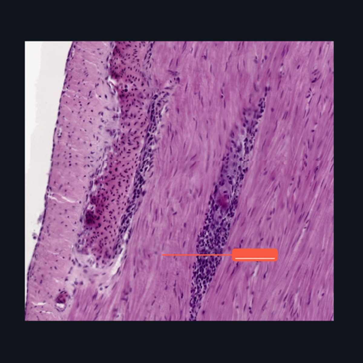 <p>Identify the structure</p>