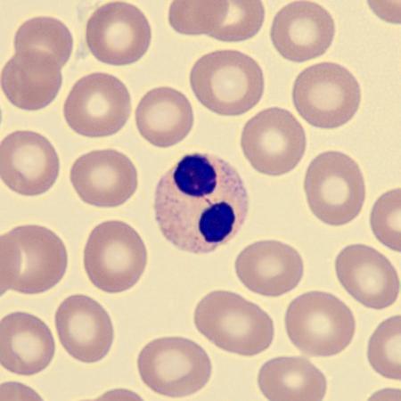 <p>What characteristics is this neutrophil showing?</p>