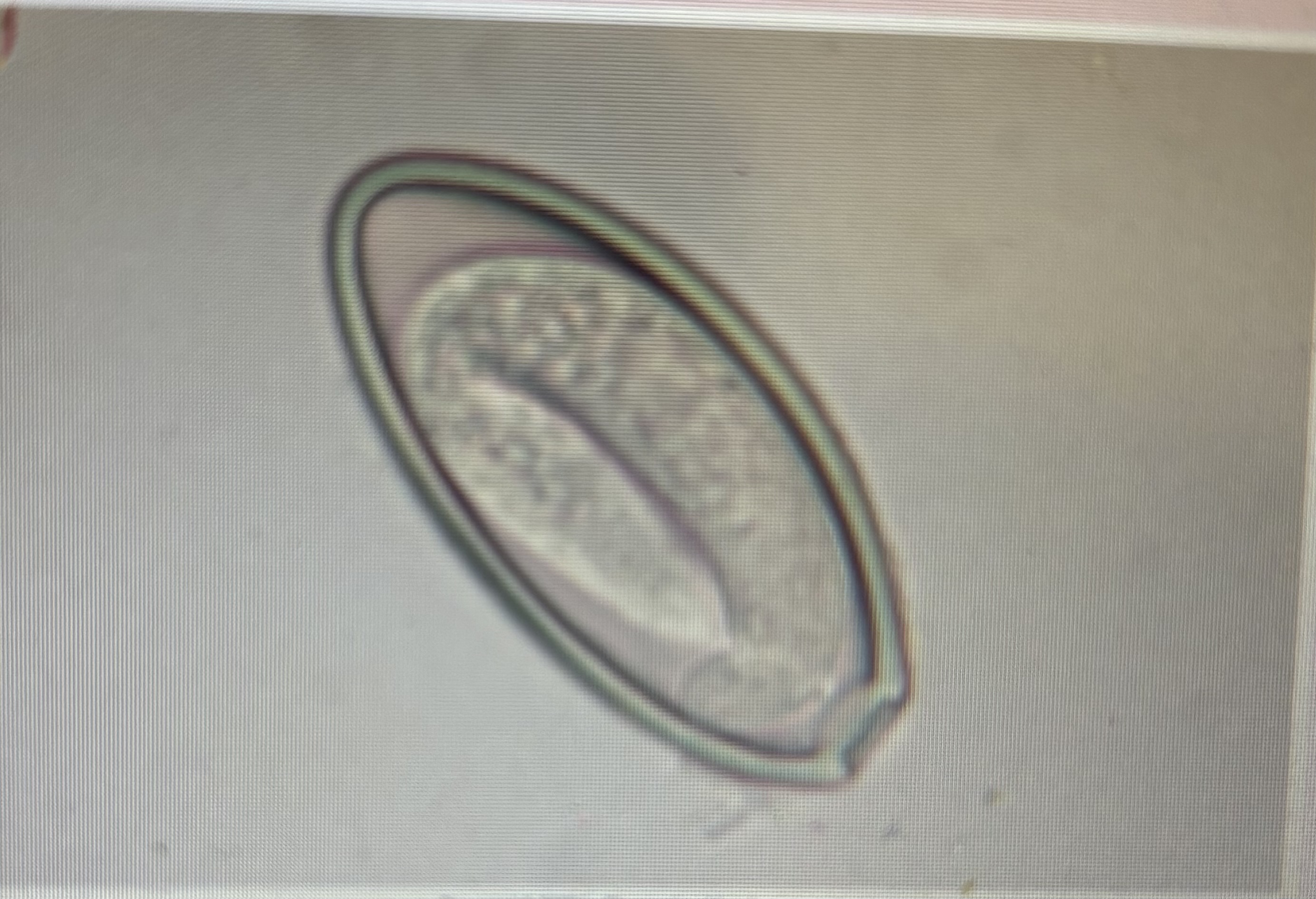 <p>Host species horse </p><p>Size 90 × 40 um </p><p>Prepatent period 5 months </p><p>Eggs may be larvated</p><p></p>