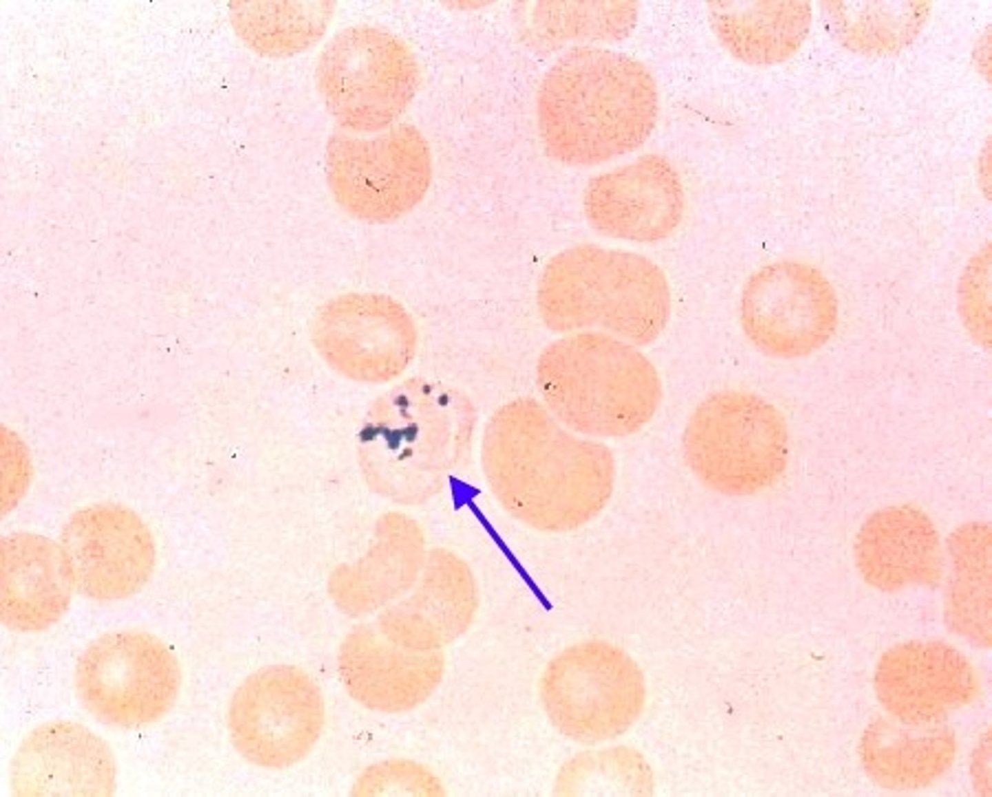 <p>- RBC with NO nucleus w prussian blue stained iron granules</p>