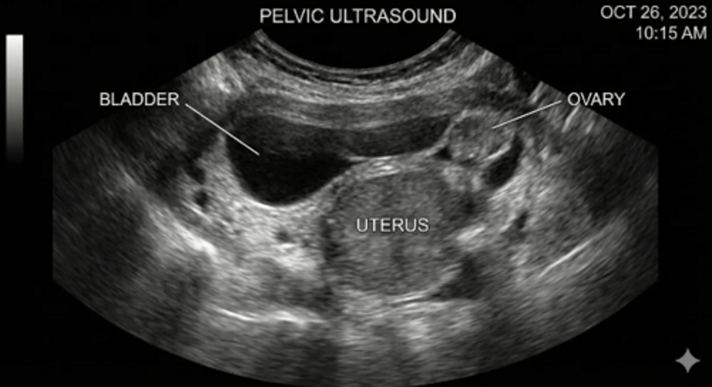 <p>Transabdominal Ultrasound</p>