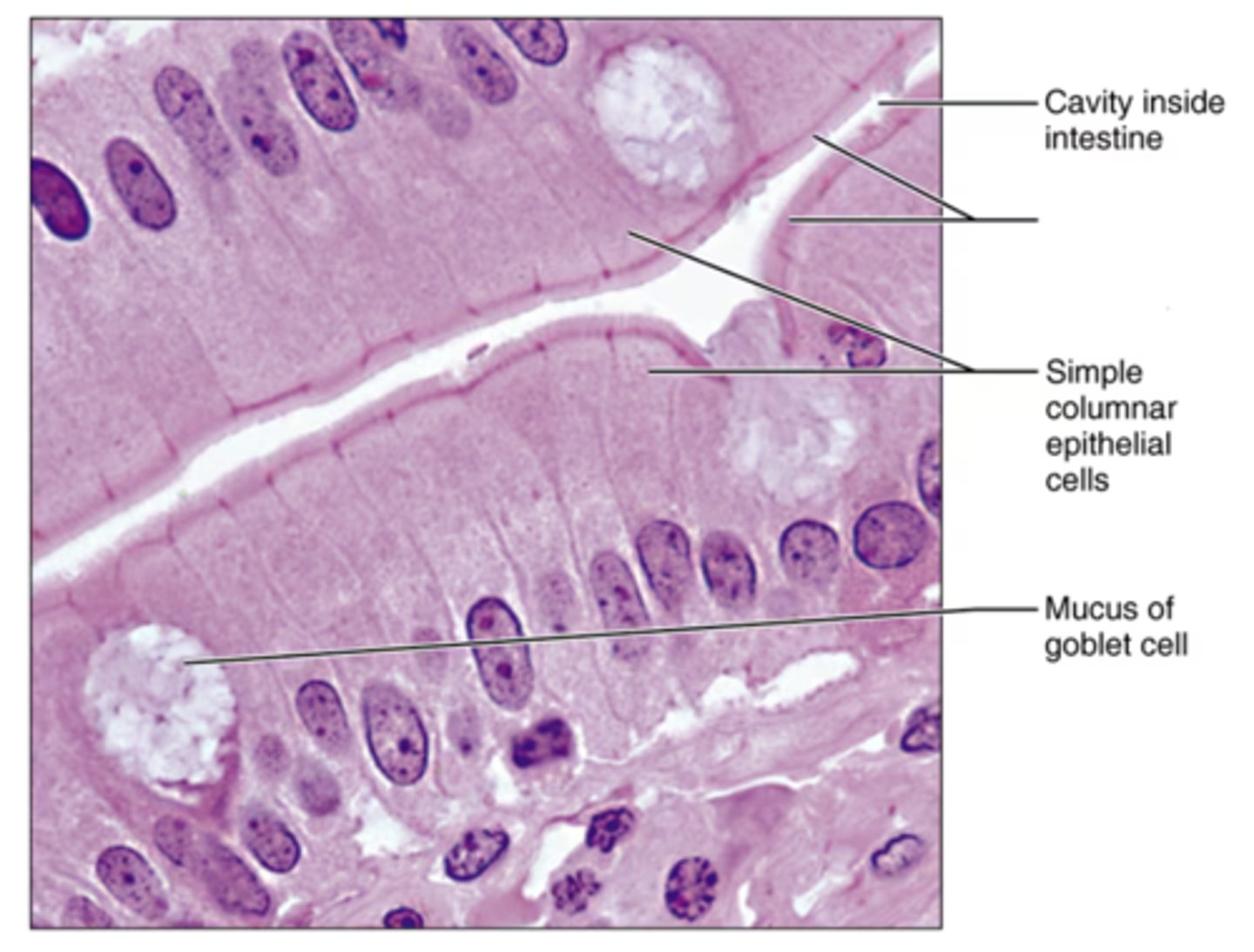 <p>What is the layer separating connective tissue from epithelial tissue?</p>