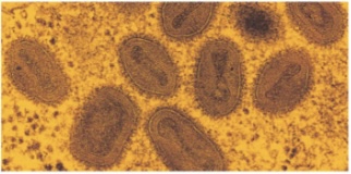 <p>Genus-Orthopoxvirus</p>