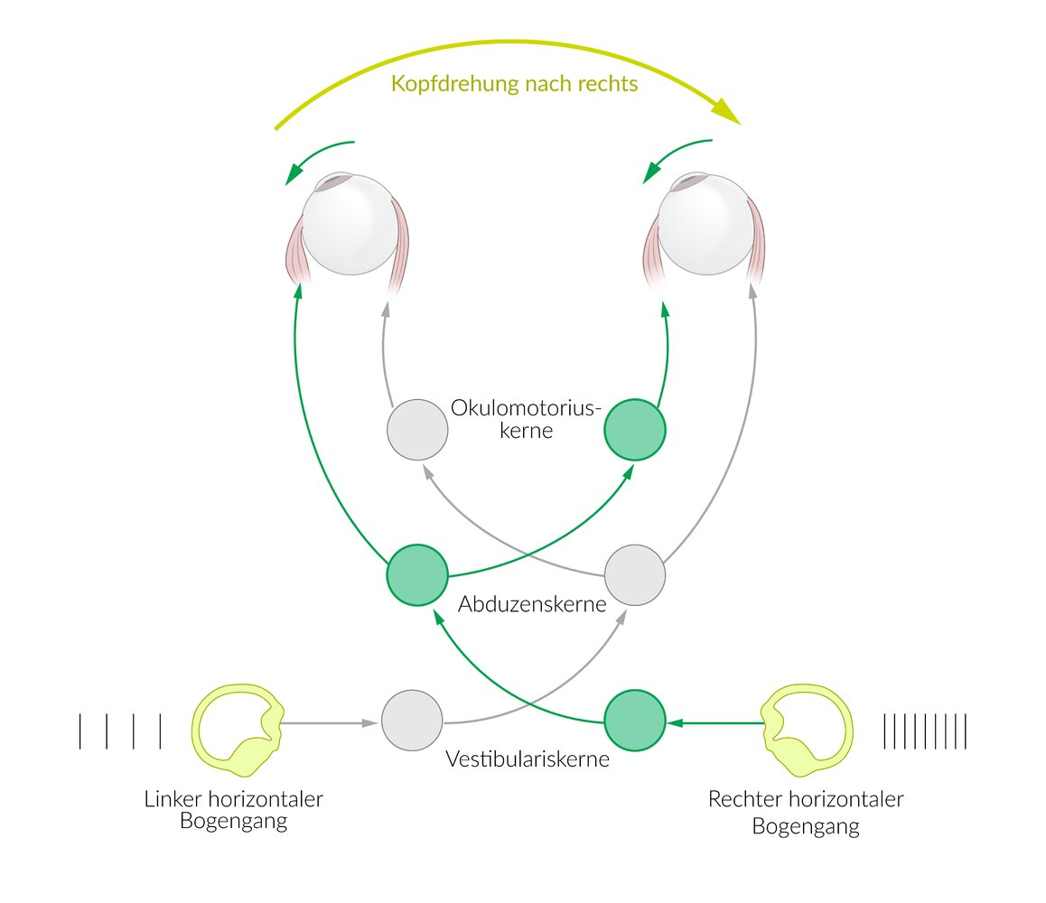 <p>A. Activation of the afferents of the left horizontal semicircular canal</p>