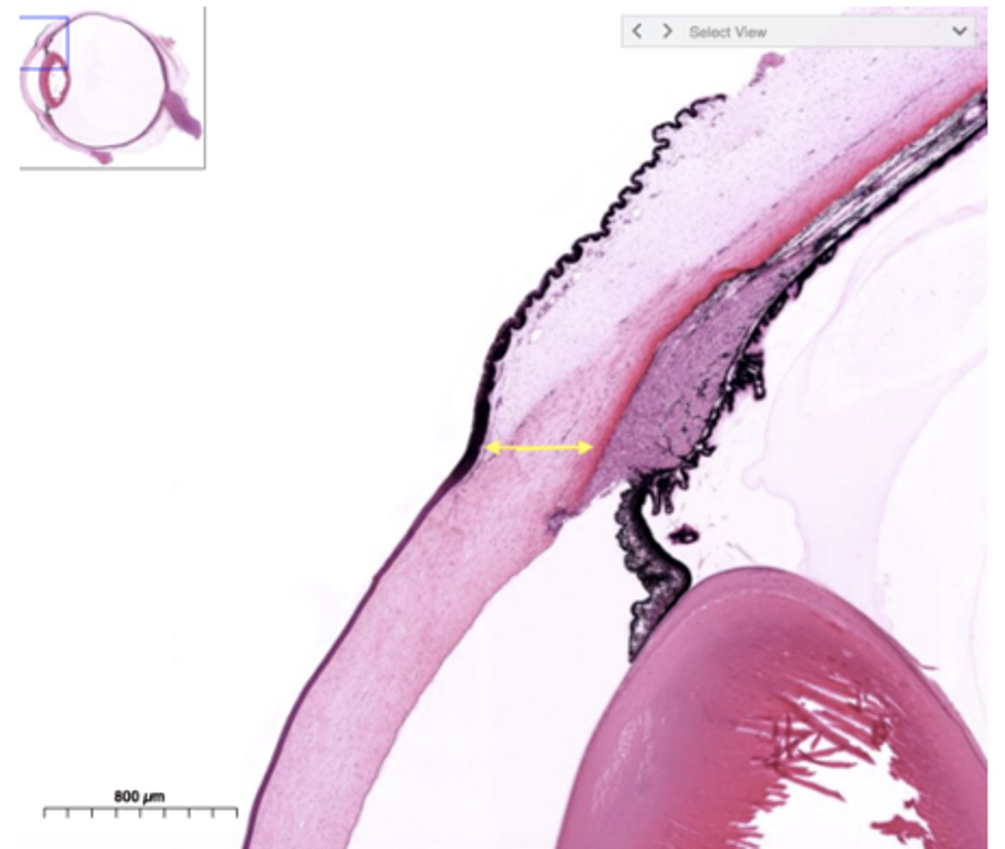 <p>Identify the transitional region</p>