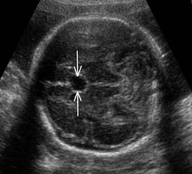<p>What is the arrows pointing to?</p>