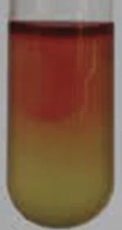 <p>Is this a positive or negative VP test?</p>