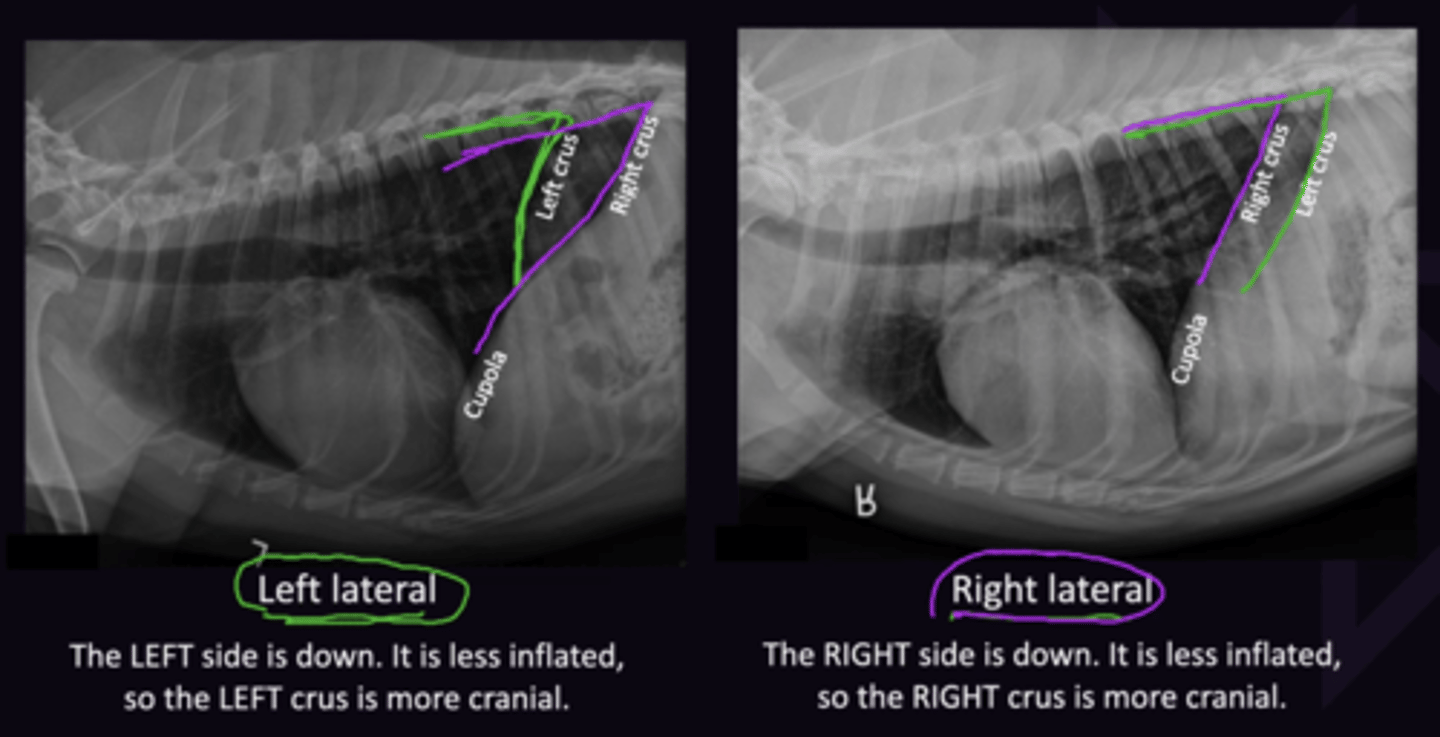 <p>1. Left Side down → Left lung cannot inflate as much as right → Left Crus more cranial </p><p>2. Right Side down → right lung cannot inflate as much as left → right Crus more cranial</p>