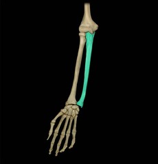 <p>medial bone of the forearm</p>