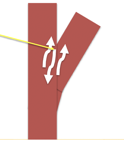 <p>Fill in the blank:</p><p>At branch points blood flow can have both forward and backward velocity components called ____ the effective velocity is ___ </p><p>( shown by arrow) </p>