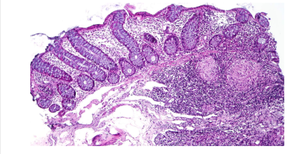 term image