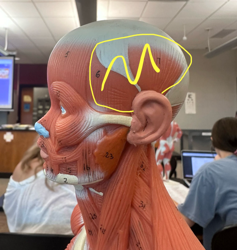 <p>What muscle is the yellow line indicating? What action does this muscle perform? </p><p>What is the origin and insertion of this muscle?</p>