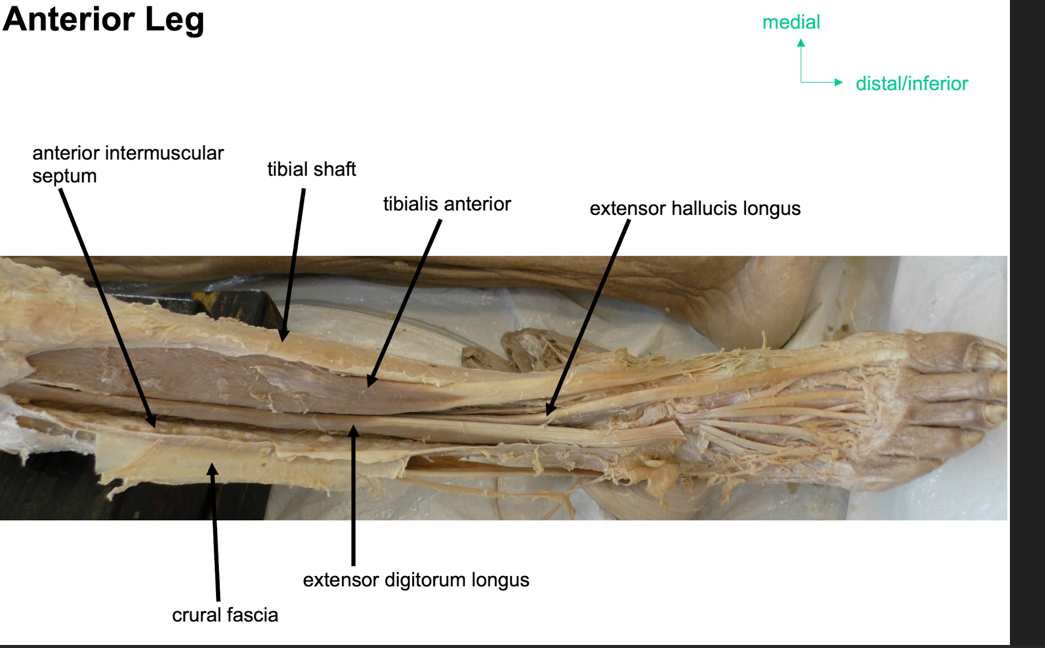 <p>Part of anterior part of leg</p><p></p><p>attachments: originates from medial surface of fibular shaft, tendor corsses anteiror to ankle joint and attaches to base of distal phalanx of great toe </p><p></p><p>actionL extnetion of great toe and dorsiflexion of foot </p><p></p><p>innervationL deep fibular enrve</p><p></p><p>artertyL anteiror tibial arterty </p>