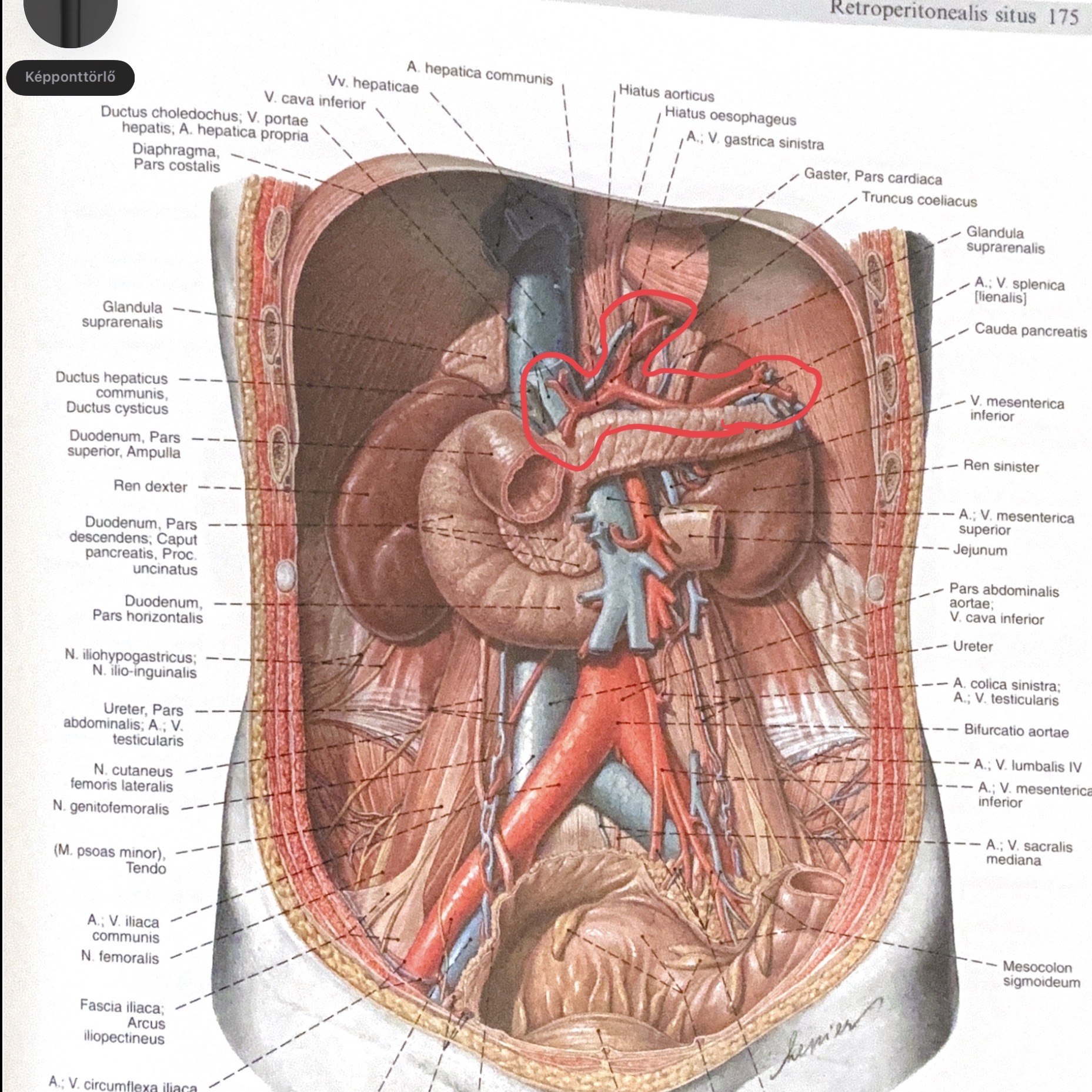 <p>truncus celiacus —> a.gastrica sinistra / a.hepatica communis / a.lienalis</p>