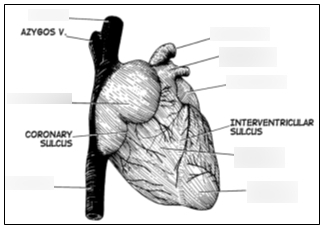 <p>The interventricular sulcus is a groove that separates the left and right ventricles on the outer surface of the heart.</p>