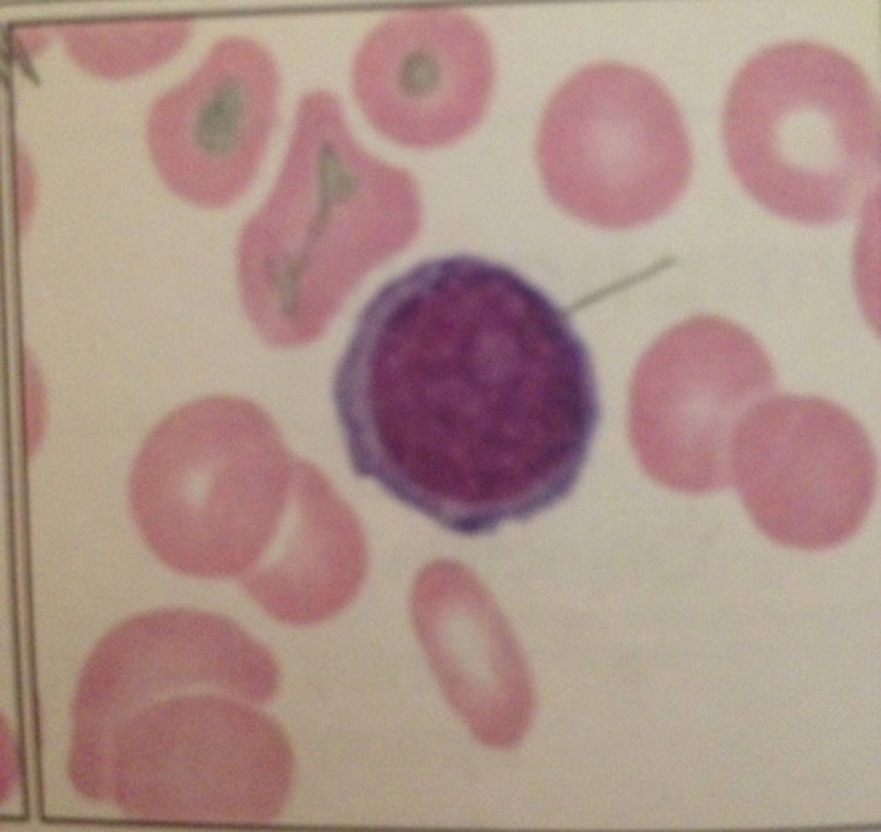 <p>slightly smaller than normal lymphocyte, nuclei still present, clumpy chromatin</p>
