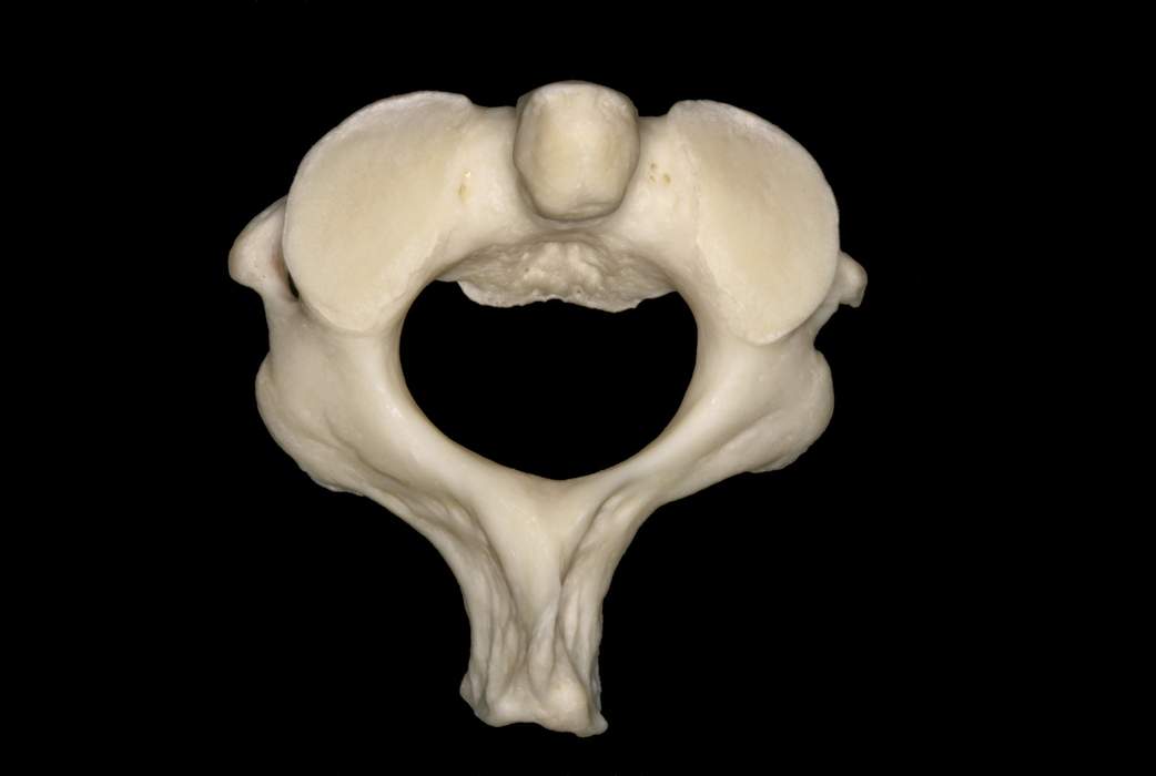 <p>(this specific vertebrae) </p>