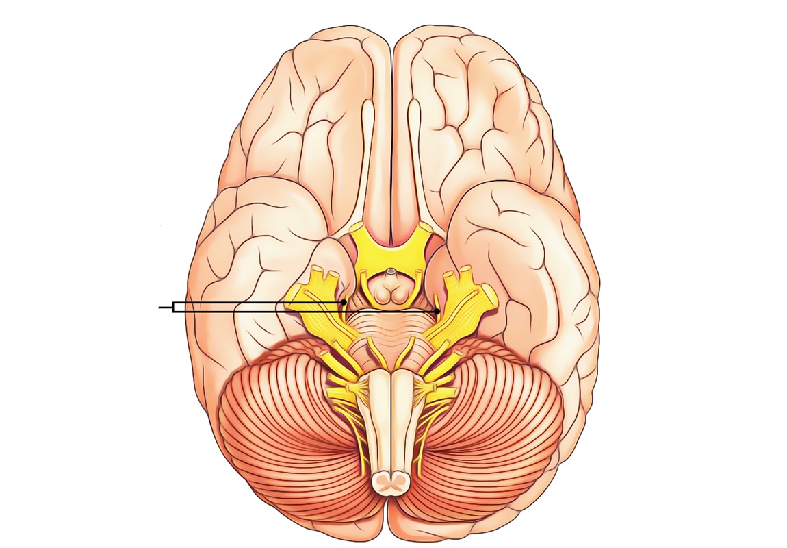 <p>What is the name and number of this craninal nerve?</p>