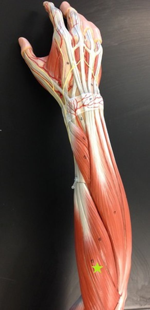<p>parallels brachioradials on lateral forearm, and may blend with it</p><p>o: lateral supracondylar ridge of humerus</p><p>i: base of second metacarpal</p><p>a: EXTENDS WRIST</p>
