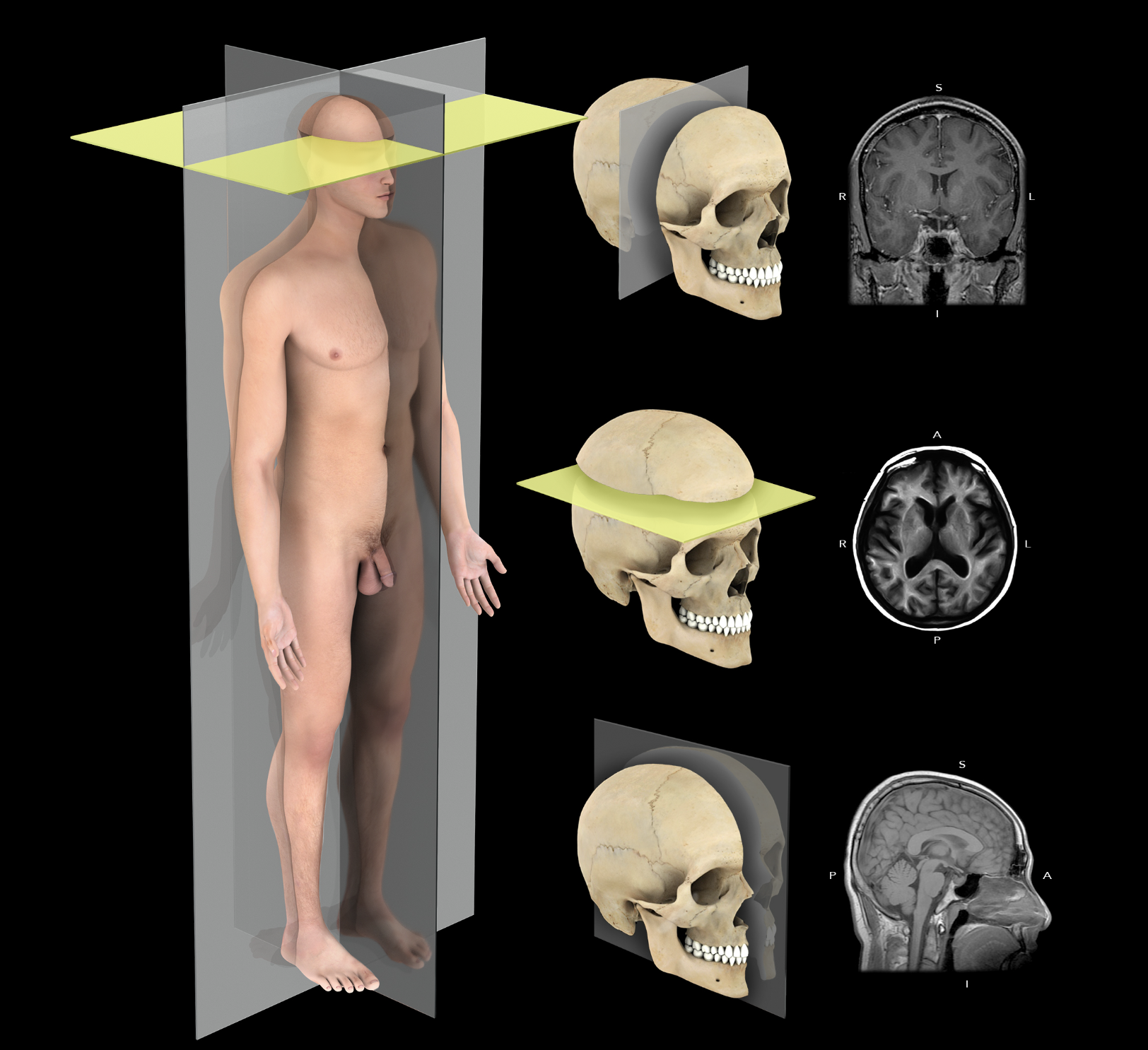 <p>Transverse Plane</p>