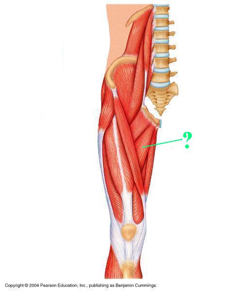 <p><span>Identify the indicated muscle</span></p>