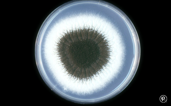 <p><em>Aspergillus niger</em></p>