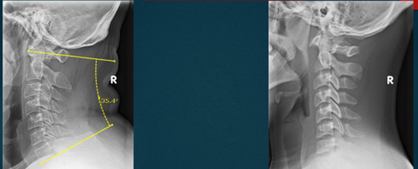 <p>What line of mensuration is this?</p>