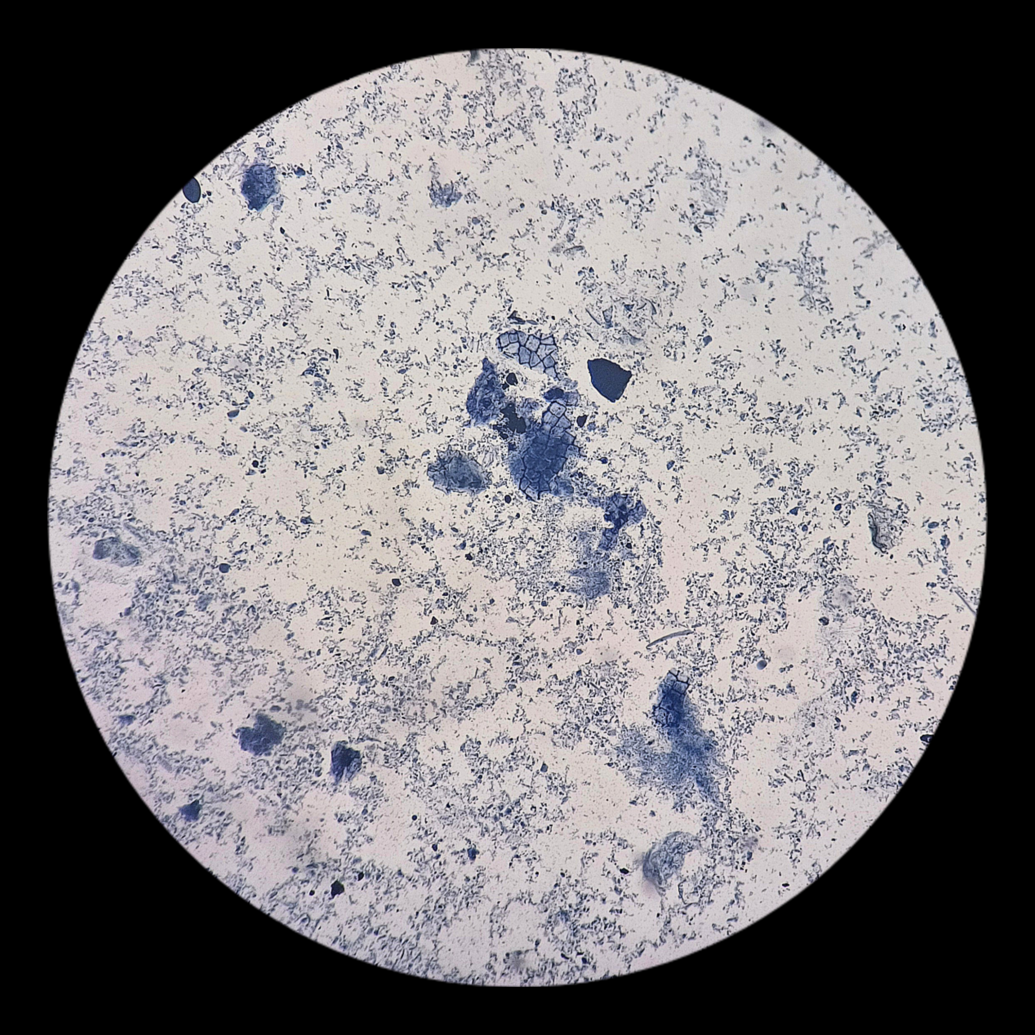 <p><strong>General characteristics:</strong></p><ul><li><p>Flagellated protozoan parasite.</p></li><li><p>Causes giardiasis, a diarrheal disease.</p></li><li><p>Found in contaminated water and food.</p></li><li><p>Distinctive pear shape with multiple flagella.</p></li></ul><p></p>