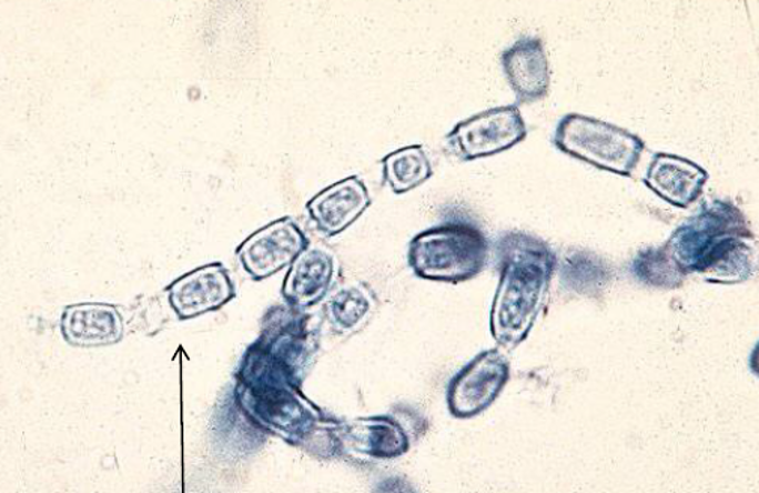 <p>Pictured below is a culture and tease prep from an organism found in a sputum specimen. What is the identification of this organism?</p>