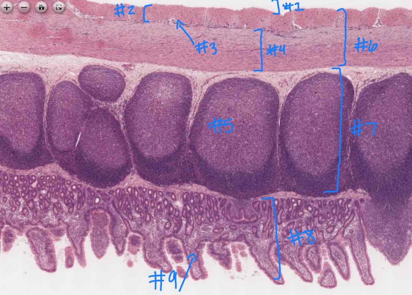 <p>What structure is indicated by #3?</p>