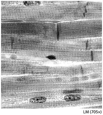 <p><span style="font-family: Lato Extended, Lato, Helvetica Neue, Helvetica, Arial, sans-serif">Name this tissue.</span></p>