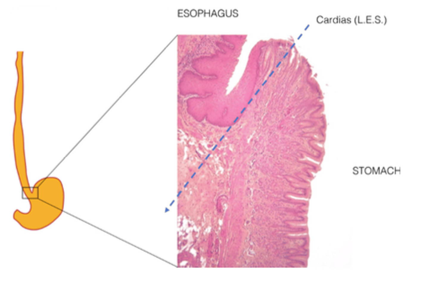 <p>The cardias (lower esophageal sphincter)</p>