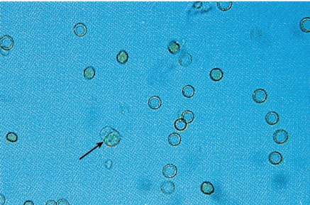 <p>cell arrow pointing at</p>