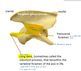 <p>It has 2 bodies: main body and long dens</p><p>Elongated spinous process</p><p>Articulates with C1 to form atlanto-axial joint (only lateral rotation)</p>