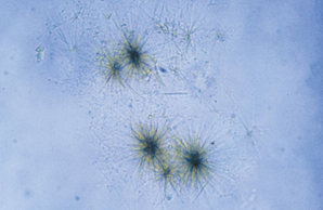 <p>Identify the urine sediment element shown:</p>