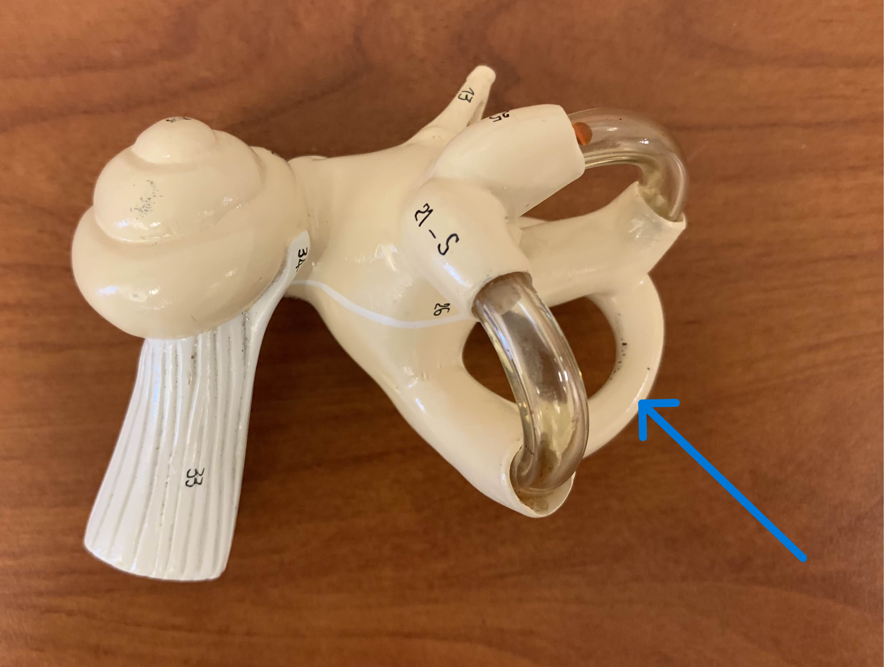 <p>Which part of the ear is:</p><ul><li><p>Pathways of the labyrinth</p></li><li><p>Three loops</p></li></ul><p></p>