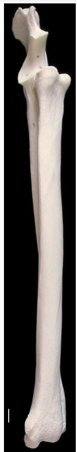 <ol><li><p>styloid process of the trochlea in the radius</p></li><li><p>trochlea of the radius: distal end of radius</p></li><li><p>olecranon of the ulna:&nbsp;biggest part of ulna, medial surf is more concave than lateral</p></li></ol><p></p>