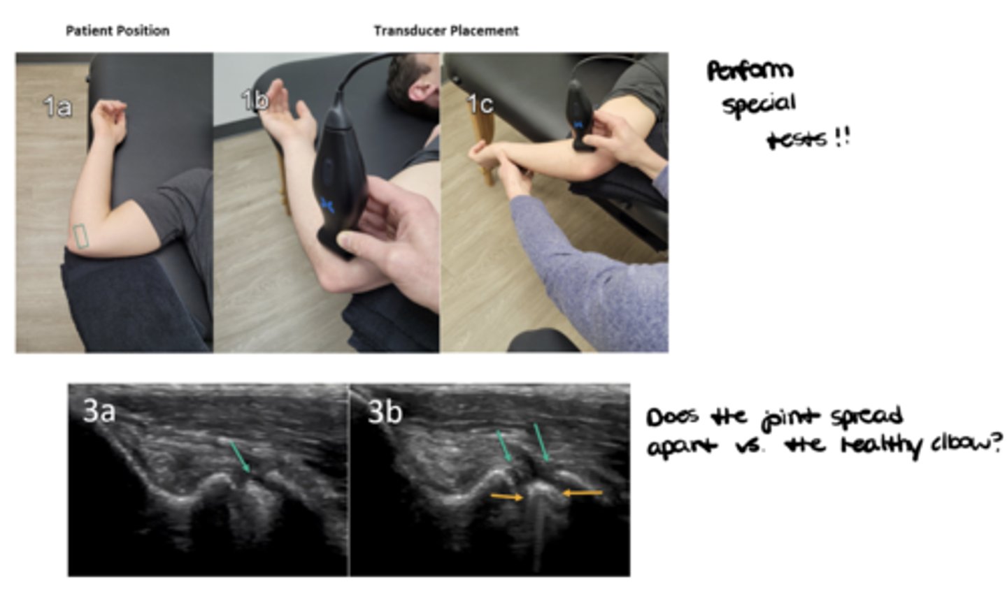<p>1. Analyze the structure implicated -- what is causing the patient's symptoms (ex: move the shoulder joint to see the biceps tendon snap in and out of the intertubercular groove OR see the impingement of the rotator cuff musculature)</p><p>2. Perform special tests -- does the joint spread apart vs. the healthy joint (ex: valgus/varus stress tests)</p>