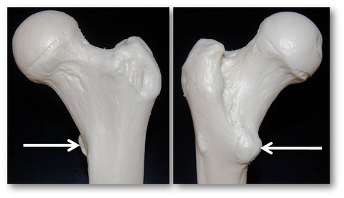 <p>Very large, blunt, irregularly shaped process on the femur.</p>