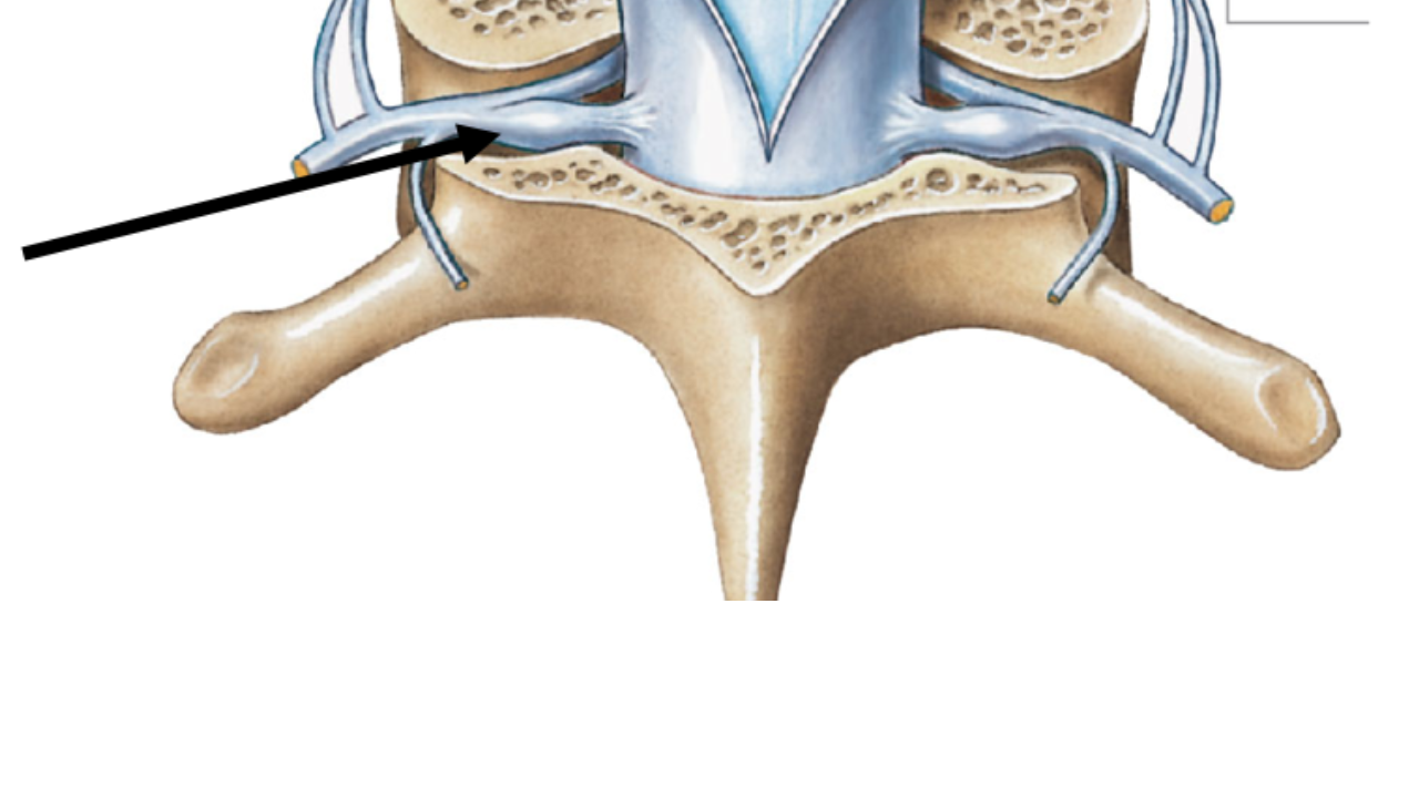 <p>spinal ganglion (sensory) </p>