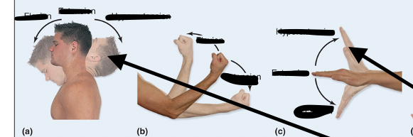<p>Overextending/flexing</p>