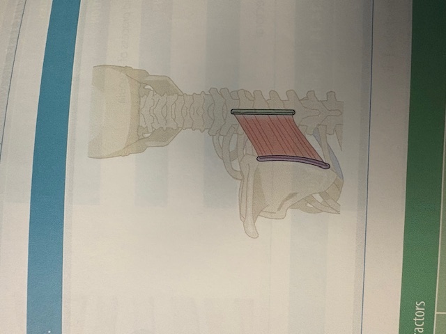 <p>Rhomboid Major</p>
